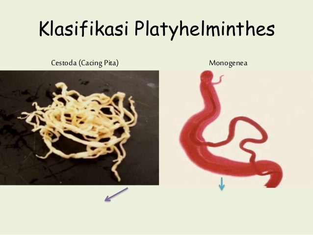 Contoh Cacing Pita